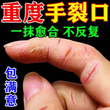 手开裂专用愈合膏手足干裂止痒皮肤干燥皲裂粗糙护手霜修复的药膏 一盒【手裂愈合膏】
