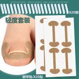 上宾甲沟矫正器嵌甲往肉里长专用隔离贴片纠正家用神器脚趾甲垫灰贴炎 【轻度嵌甲专用】正甲垫片20根+嵌甲垫20根