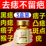 茉博士香港大药房去痣点痣膏药水脸部不留疤黑痣无痛修复液