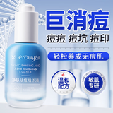 BEAUTY NOTES水杨酸祛痘舒缓控油淡化痘印祛闭口青少年护肤12-18岁精华液30ml