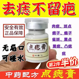 佰萃莱去痣点痣膏药水脸部不留疤祛黑痣香港无痛修复液大药房点尤可用