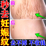 秋雅奈绪妊娠纹修复霜产后去疤痕消除紧致肚皮松弛专用淡化祛生长肥胖纹膏 买3赠2【巩固装】 妊辰纹膏 日本祛疤痕油孕妇原装进口