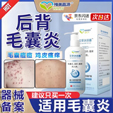 毛囊炎沐浴露后背部长痘痘马拉色菌痤疮湿疹皮炎止痒抑菌神器洗液 单盒体验装【无惧皮肤问题】