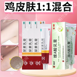 马应龙 尿素乳膏 手足皲裂膏 角化型手足癣手脚开裂 手脚干裂皮肤外用软膏 3盒尿素乳膏+1盒维a酸乳膏 鸡皮肤混合使用