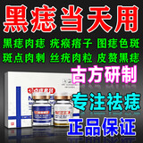 点痣膏水疤痕修复脸部去痣点痣膏官方正品祛斑点斑专用非药点疣水 1盒新款【点痣专用】