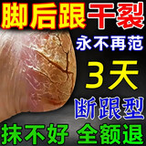 脚裂膏脚后跟干裂开裂干燥脱皮真菌去老茧蛇油皲裂膏手足润肤霜 1瓶试用装【一抹愈合开裂】 一抹愈合干裂去死皮滋润手脚保湿