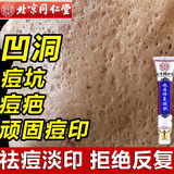 同仁堂祛痘印修复淡化痘印痘坑修复凹洞去痘坑去痘疤去痘痘和痘印粉刺 一盒装【拍二发三】