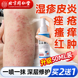 同仁堂皮炎湿疹喷剂皮肤瘙痒真菌感染止痒膏汗泡痤疮疹私处瘙痒膏50ml