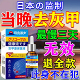 亮甲日本灰指甲特傚效药第1名根i治正品真菌感染增亮灰指甲进口抑菌 买2送1【100%根除】增亮破厚甲 增亮厚甲灰指甲专用京东大药房