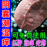 山本中村制薬男士私处瘙痒药膏护理液阴囊潮湿瘙痒男人专用止痒去i根睾丸潮湿 单盒装 男士下体睾丸潮湿私处瘙痒膏