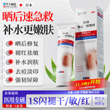 久卜制药修复皮肤晒后搭芦荟胶祛痘痘印淡化疤痕医用消炎止痒补水保湿3支