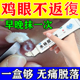 水杨酸软膏去鸡眼膏去根肉刺药i膏无痛脱落连根拔软化角质去鸡眼去病根药i膏鸡眼去除特正效药跖疣老茧 1盒【脚鸡眼专用药】