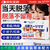 井次制药去痣点痣膏水无痕脸部痦子扁平疣瘊子面部黑痣男女士通用