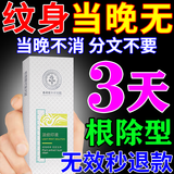 洗i纹身药水正品去i纹身专用修复膏药神器专用不留疤痕永久去除液 一盒装【效果好怕不够用】