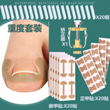 上宾甲沟矫正器嵌甲往肉里长专用隔离贴片纠正家用神器脚趾甲垫灰贴炎 【重度嵌甲专用】告别甲沟问题