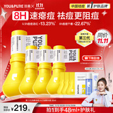 羽素祛痘大灯泡3.0 陈梦推荐 祛痘精华青春痘姨妈痘护肤品学生去痘痘