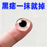 日本医用点痣膏点痣点疣药水美容院祛痣膏去黑痣专用脸部不留疤痕修复 单盒【祛痣无痕无效退】 美容院专用不留疤点痣膏日本进口