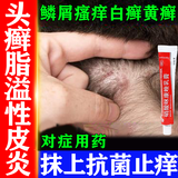 [扬子洲]硝酸咪康唑乳膏 2%*20g 1盒装 体股癣牛皮肤癣专用特正效药银屑病药膏止痒抑菌皮肤皮炎湿疹皮癣真菌感染止痒膏 头癣特药效真菌感染头皮屑