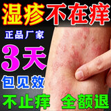 夫洁美宝苗药湿毒清软膏成人湿疹膏皮肤瘙痒止痒皮炎湿疹真菌王止痒膏去根 顽固湿毒湿疹药膏十大牌子-1盒