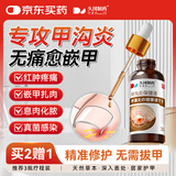 久冈制药甲沟炎专用灰指甲息肉红肿去肉芽发炎流脓外用膏药嵌甲沟炎矫正器