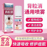 TOOLDOO背粒消喷雾60ml背立消祛痘毛囊炎胸前硬疙瘩痘印后背部