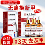 内廷上用同仁堂灰指甲灰甲净药专用指甲真菌感染特效脱甲增厚抑菌液+锉刀