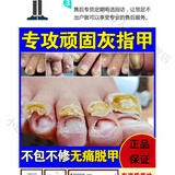 【官方】灰指甲无痛脱甲膏可搭郑远元脱甲膏指甲增厚变形碎屑粉末状灰甲软化控菌抑菌修护专用膏 无痛脱甲+抑菌液（1-3坏甲）