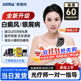 希格玛308白癜风治疗仪西格玛UVB银屑病紫外线准分子激光光疗仪医院同款 【小面积高效顽固型】60强度SQ308PCAaFE