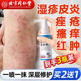同仁堂皮炎湿疹喷剂皮肤瘙痒真菌感染止痒膏汗泡痤疮疹私处瘙痒膏3盒