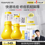 羽素祛痘大灯泡3.0 王青推荐 祛痘精华快速祛痘痘青春期去痘护肤品