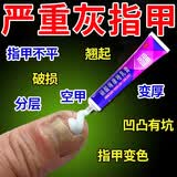 [福元]硝酸咪康唑乳膏 治疗灰指甲专用药最特新效药指甲增厚发黄变厚重度指甲手足真菌感染根药治皮肤用药 2%*15g 2盒装 【疗程装】