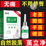 【官方药房店】茧立净去老茧子手脚厚茧立净御圣世家手足部脚钉硬皮脚茧子脚护理脚垫旗艦 【1瓶】 茧立净【一盒装】