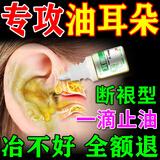 油耳朵清洁神器烂耳朵滴耳液药吸耳屎软化耵聍清理耳道耳闷耳痒液 一盒装（发货特效快）