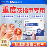 久卜制药日本灰指甲专用重度指甲根真菌感染脱坏甲发黄增厚抑菌液喷剂3盒
