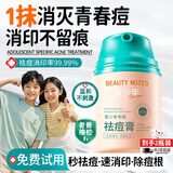 BEAUTY NOTES青少年祛痘膏男女学生护肤品12-18岁青春痘淡化痘印粉刺痘坑2瓶装