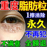 脂肪粒去除药膏神器眼部专用眼霜消除汗管瘤脂肪油脂粒粟丘疹克星 特效:买2送1【快速去除】 脂肪粒去除神器眼周专用去小颗粒清肌眼霜