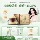珂语苦参根祛痘膏草本植萃去痘痘和痘印痤疮炎痘青春专用痘坑面霜护肤 祛痘膏1瓶+洗脸巾