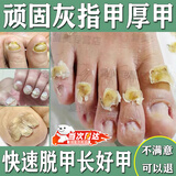 脱甲精油脱甲膏液灰指甲专用玉指露软化脱落剂坏甲增厚黄真菌感染 玉指露灰指甲脱甲精油