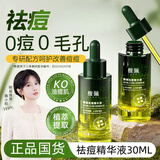 馥珮祛痘精华水30ml杨酸去痘舒缓精华液青春痘痕湿敷淡化改善痘肌