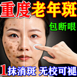 碧素堂祛斑霜老年斑专用特效非药一夜消强力祛除手部脸部男女祛斑专用霜 买三送二 祛斑效果最好的产品