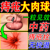 槐康宝槐实栓丸痔疮药医用纯手工中药熬制膏栓肉球内外痔混合痔脱肛用品 【36粒重度痔疮装】肝门肉球内外痔混合痔（通用款） 药店同款纯中草本配方槐角栓中药马应龙痒外肛专用固体