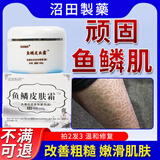 鱼鳞皮肤专用滋润保湿护肤小腿蛇皮肤纹路鸡皮肤防干燥脱皮身体乳 买2发3【中度鱼鳞皮肤使用】 官方正品