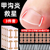 格蒙甲沟矫正器贴片炎嵌甲神器防脚指甲往肉里长专用隔离工具填充垫片