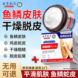 ADPWY鱼鳞皮肤专用可搭药膏小腿干燥起皮鱼鳞皮肤霜腿部蛇皮腿去除神器