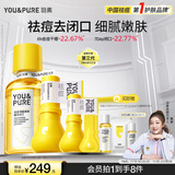 羽素祛痘大灯泡闭口水套组 快速祛痘精华液去闭口粉刺控油爽肤水