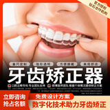 曙美牙齿矫正器龅牙牙缝地包天儿童成人整牙隐形牙套定制式透明矫治器 全国1600+门诊 曙美口腔提供专业服务