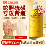 BEAI蛇胆硫磺除螨皂液沐浴露男士专用女沐浴保湿祛螨虫背痘沐浴液1L 