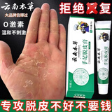 云南本草手足脱皮膏 手指上起皮干燥手掌严重蜕皮脱皮手心手脚掉皮止痒膏 云南本草手足脱皮药膏1盒20g/盒