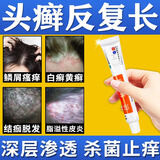 [华青]硫软膏 10%*20g 1盒装 治头癣特用药有效治头皮癣药头皮痒脂溢性皮炎头皮屑多真菌感染皮肤用药非处方药硫软有成人 标准装