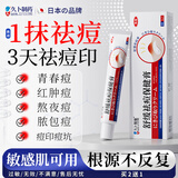 久卜制药祛痘药膏青春痘祛痘淡化痘印痘坑消炎痤疮粉刺专用学生青少年 1盒